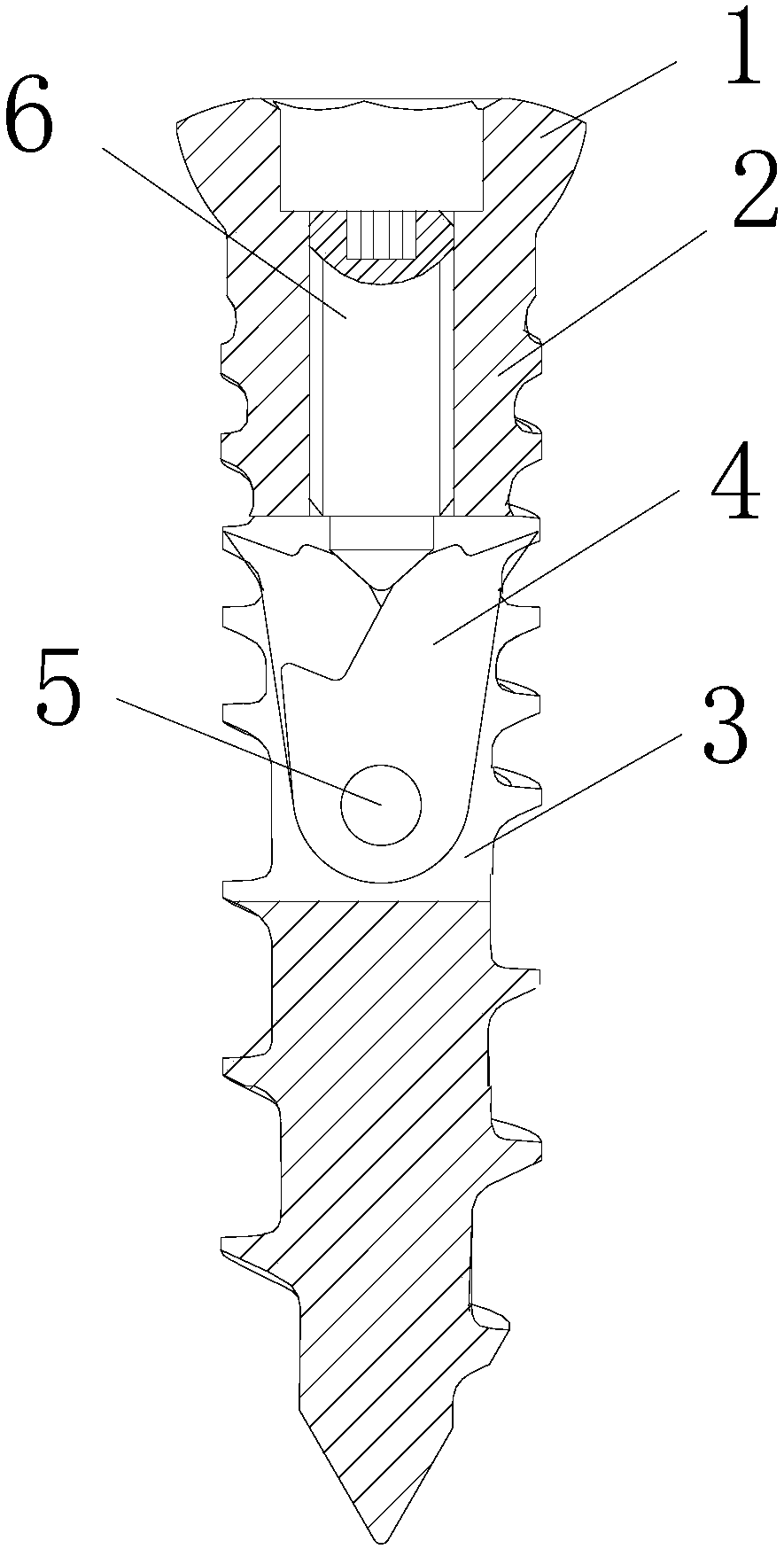 Hook type orthopedic bolt