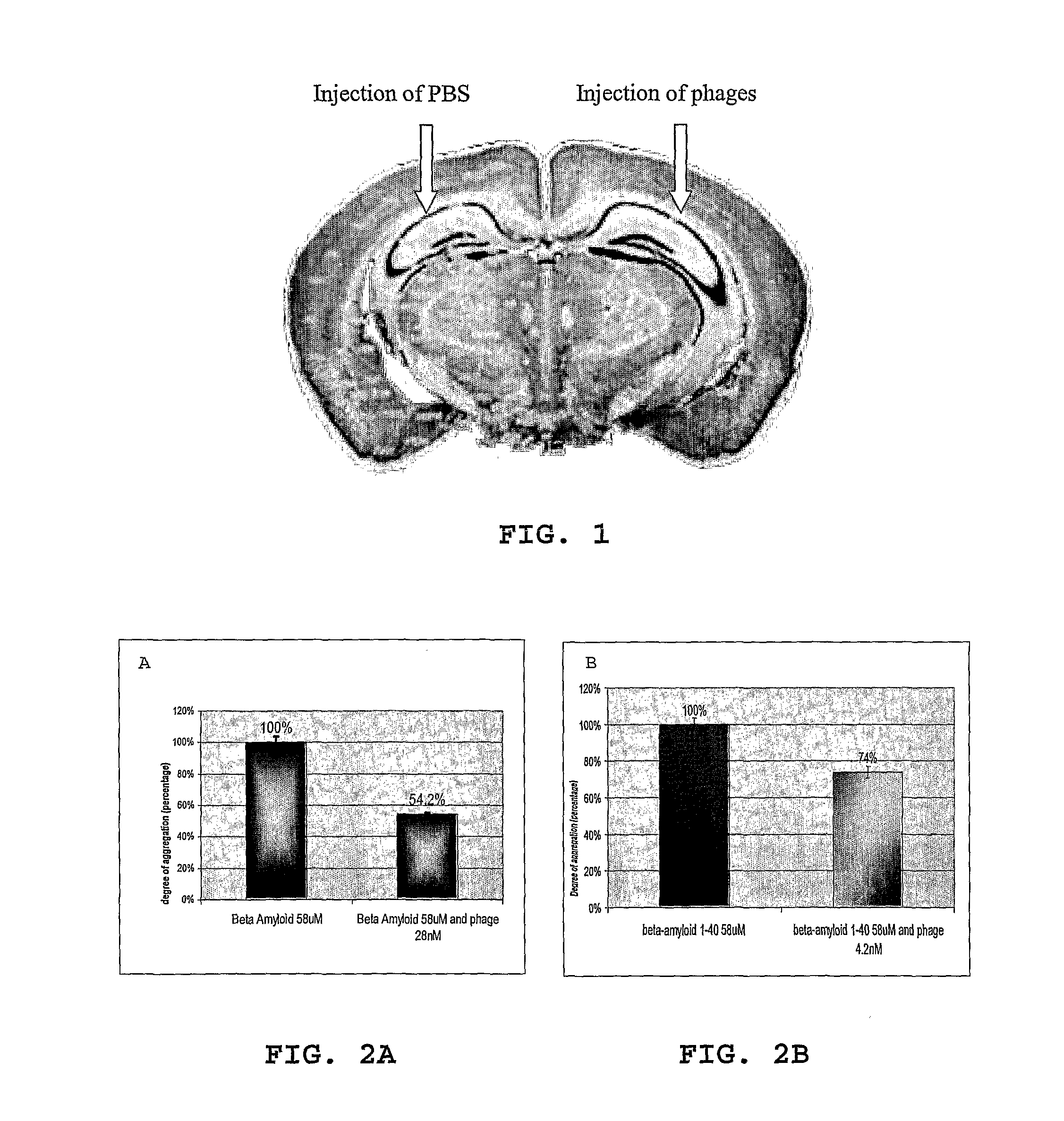 Method for treating inflammation associated with amyloid deposits and brain inflammation involving activated microglia