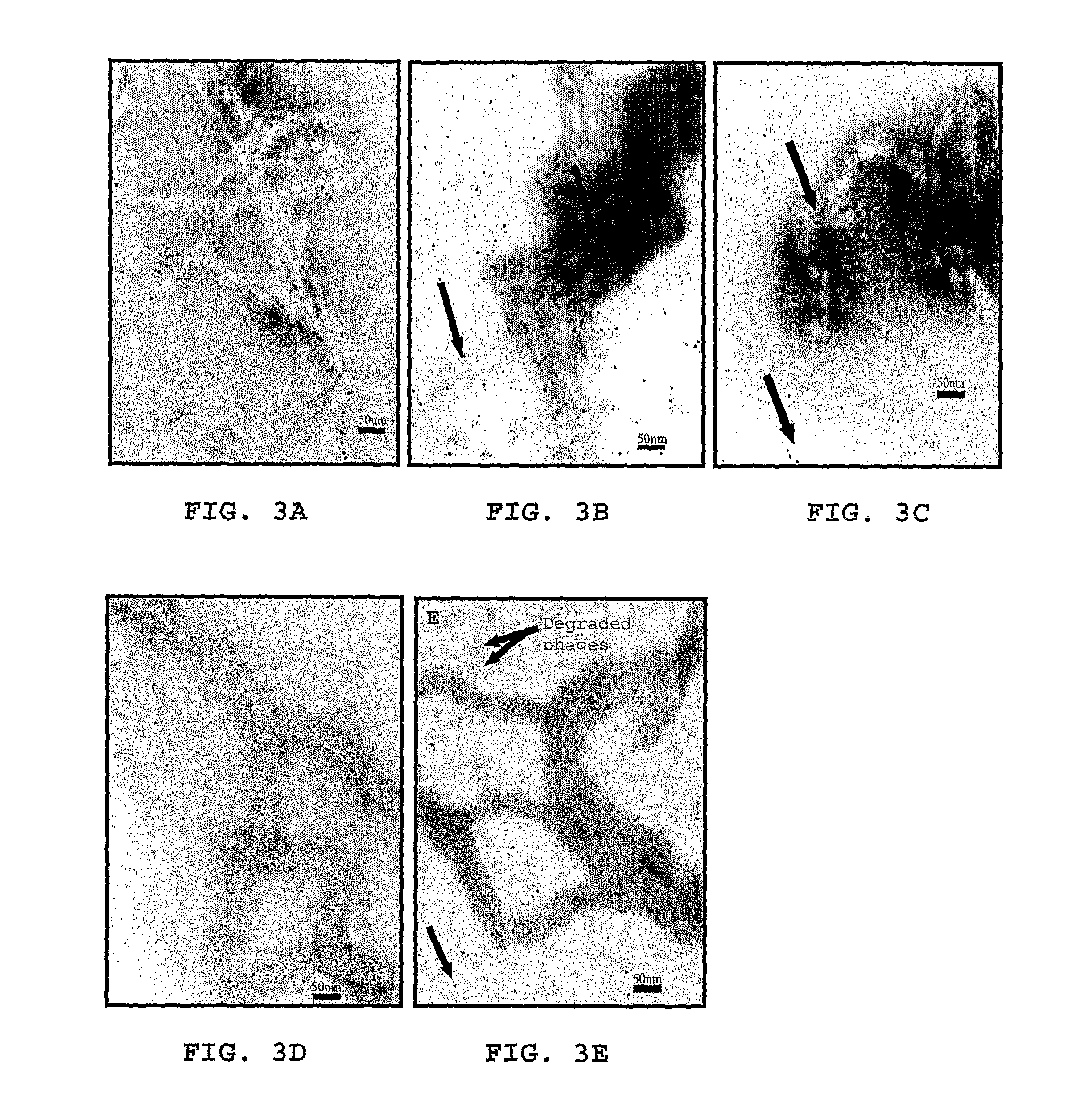 Method for treating inflammation associated with amyloid deposits and brain inflammation involving activated microglia