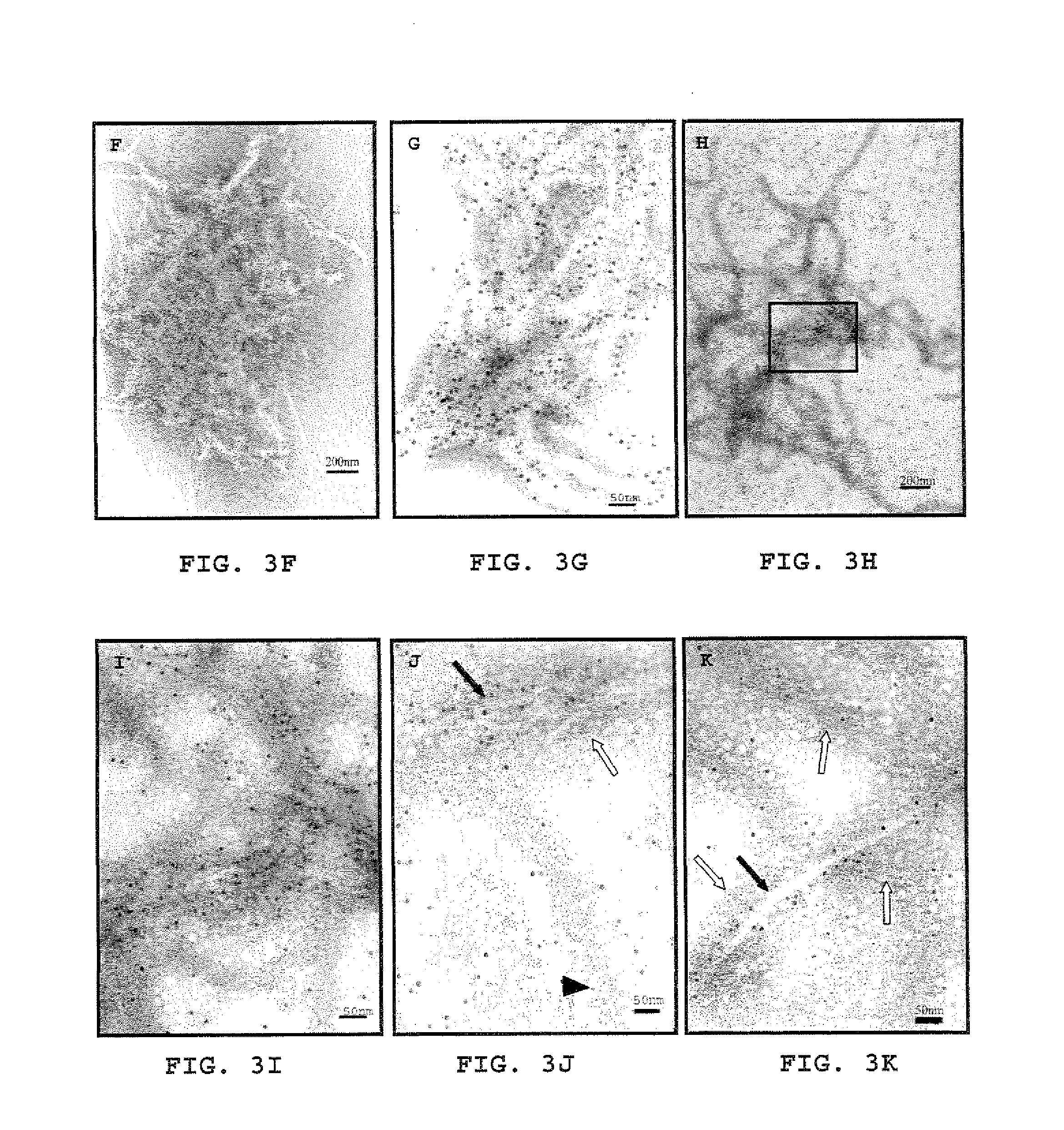 Method for treating inflammation associated with amyloid deposits and brain inflammation involving activated microglia