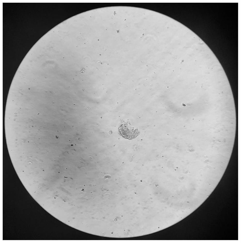 Method for obtaining salivary gland stem cell mass of hirudo nipponia through enzymolysis and application of salivary gland stem cell mass