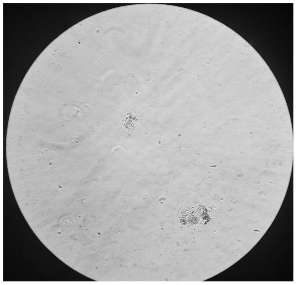 Method for obtaining salivary gland stem cell mass of hirudo nipponia through enzymolysis and application of salivary gland stem cell mass