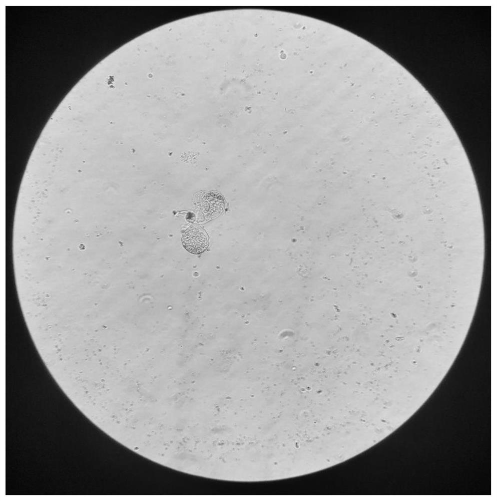 Method for obtaining salivary gland stem cell mass of hirudo nipponia through enzymolysis and application of salivary gland stem cell mass