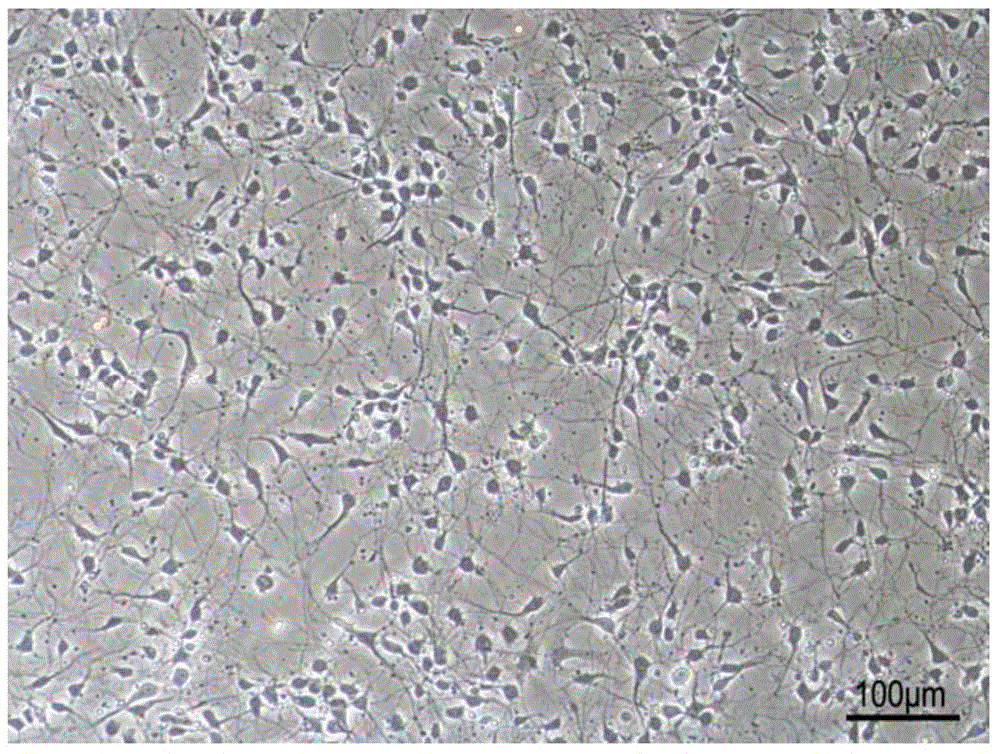 Intracranial and spinal excitotoxicity injured cell network model and building method and application thereof