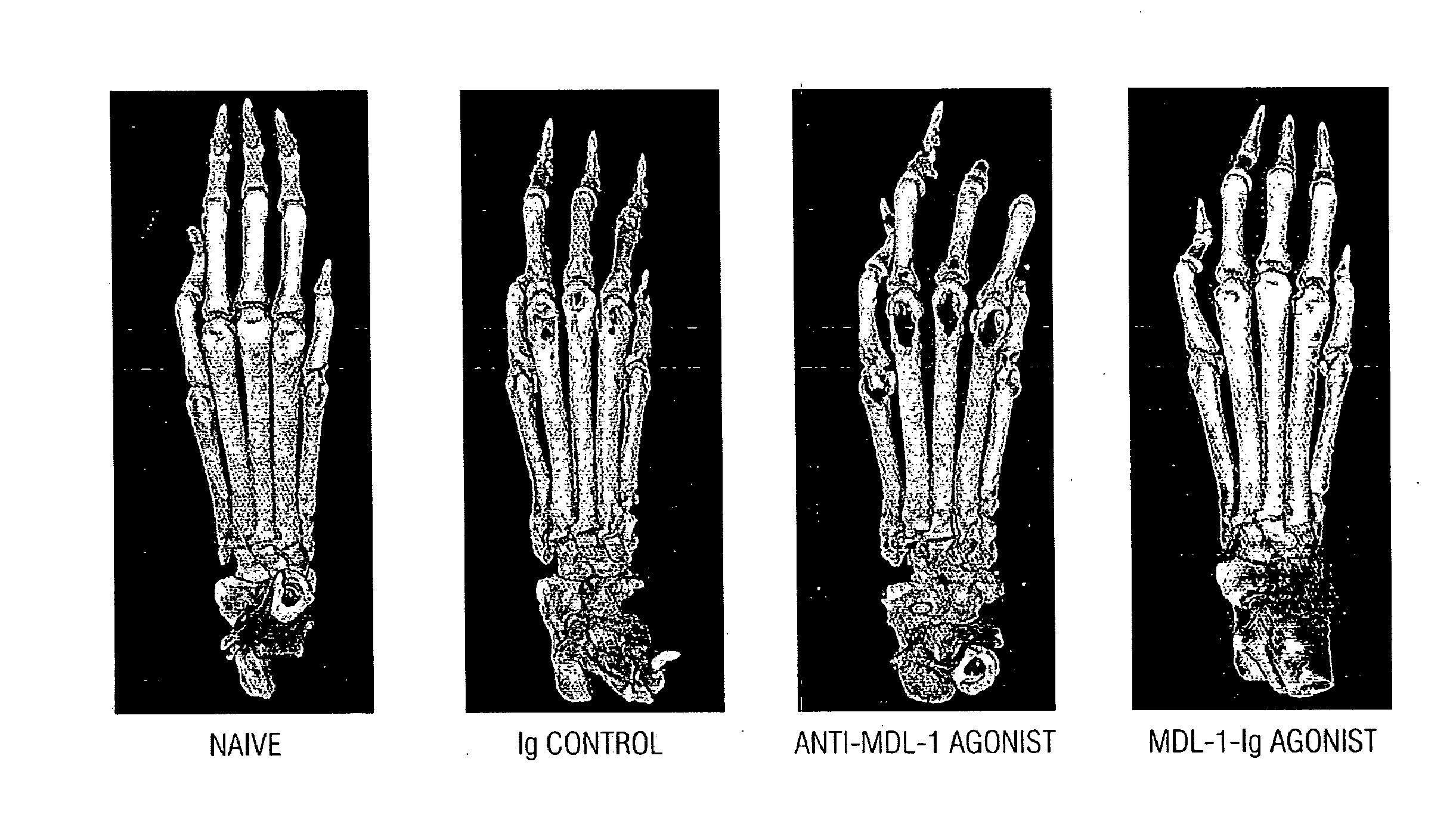 Mdl-1 uses