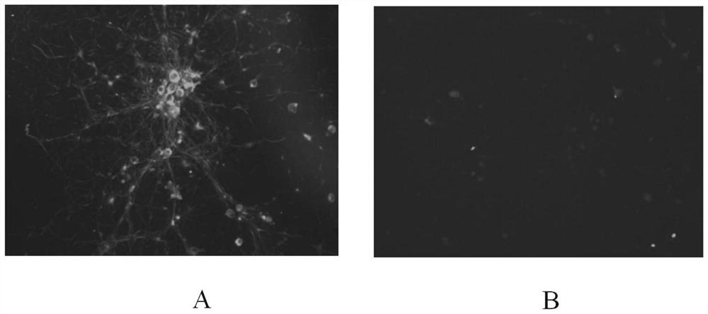 Application of anti-CAMK2A autoantibody reagent in preparation of kit for diagnosing nervous system symptom related diseases