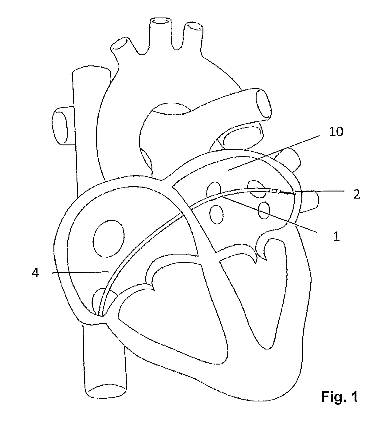 Electrode catheter device