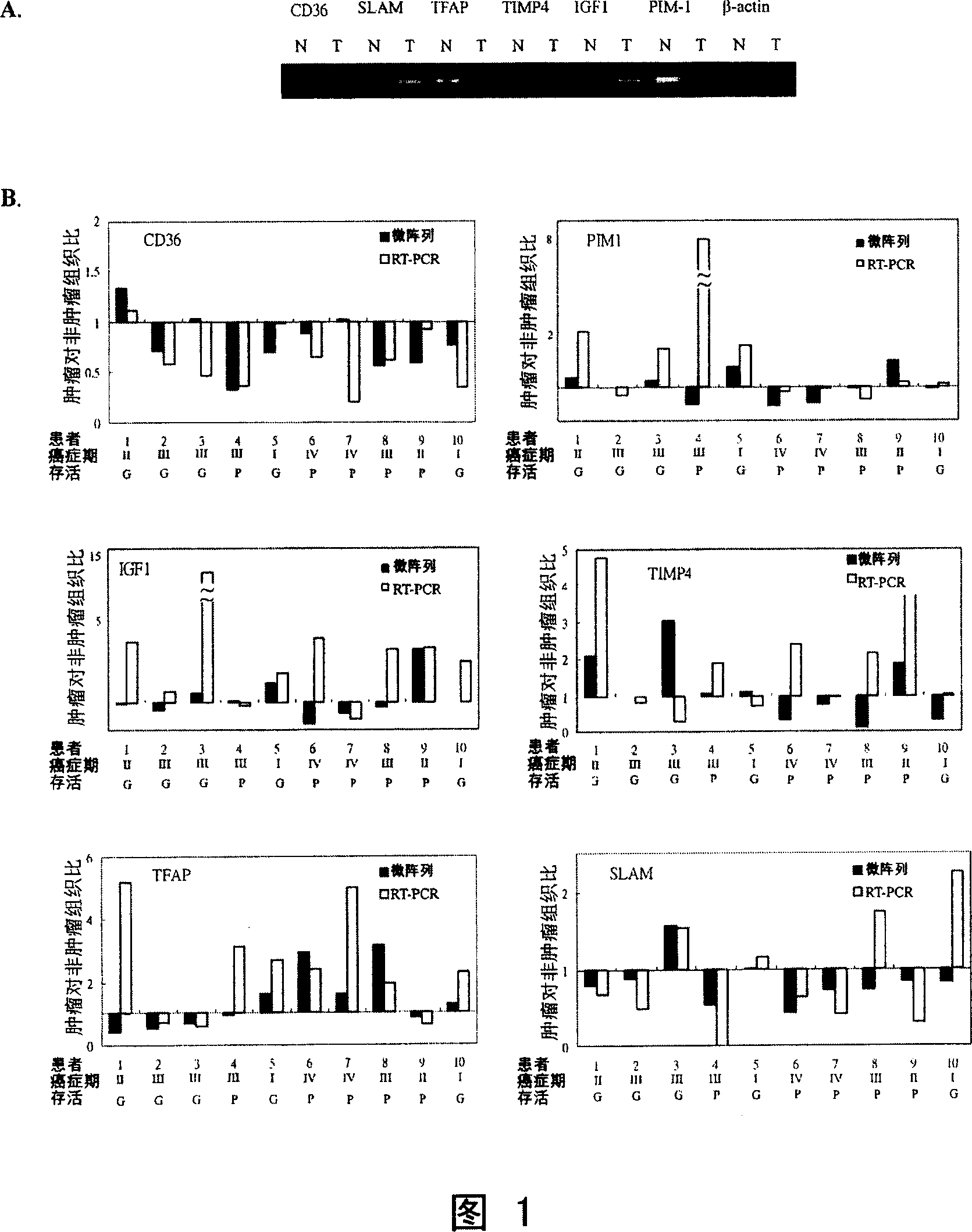 Method of forecasting gastric cancer postoperative survival condition by gene expression atlas