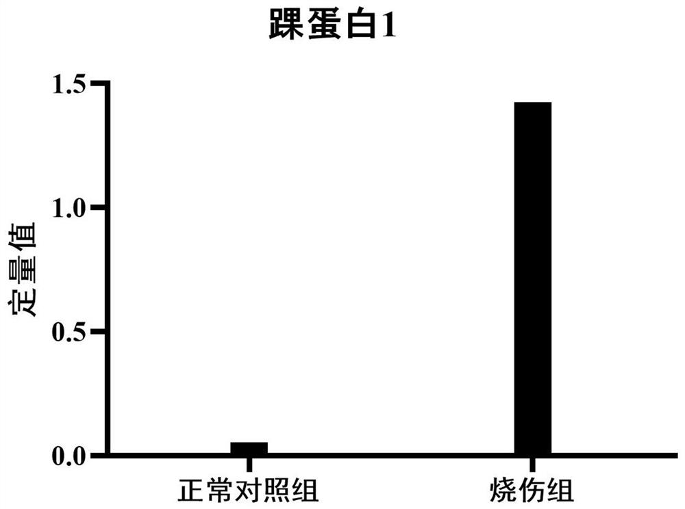 Application of urine ankle protein 1 and polypeptide fragment thereof in burns