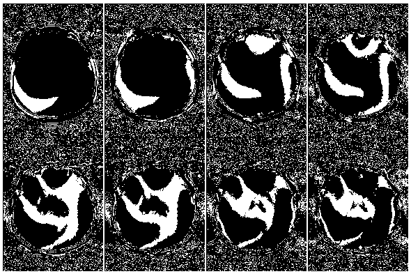 A Method to Eliminate the Even and Odd Phase Differences of MRI Gradient Echo Sequences