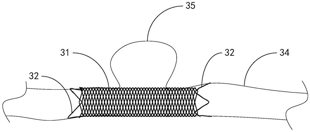 Intracranial stent and intracranial stent conveying system