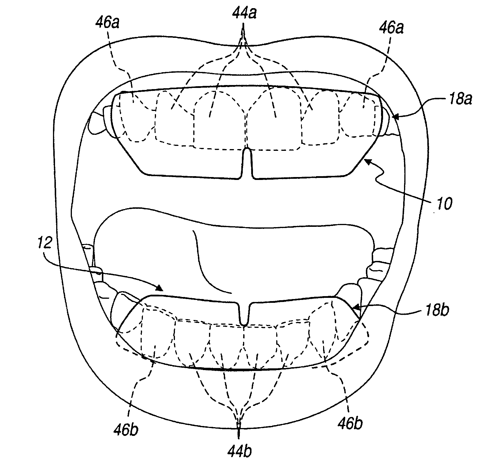 Carrier strip for application to oral surfaces and related methods