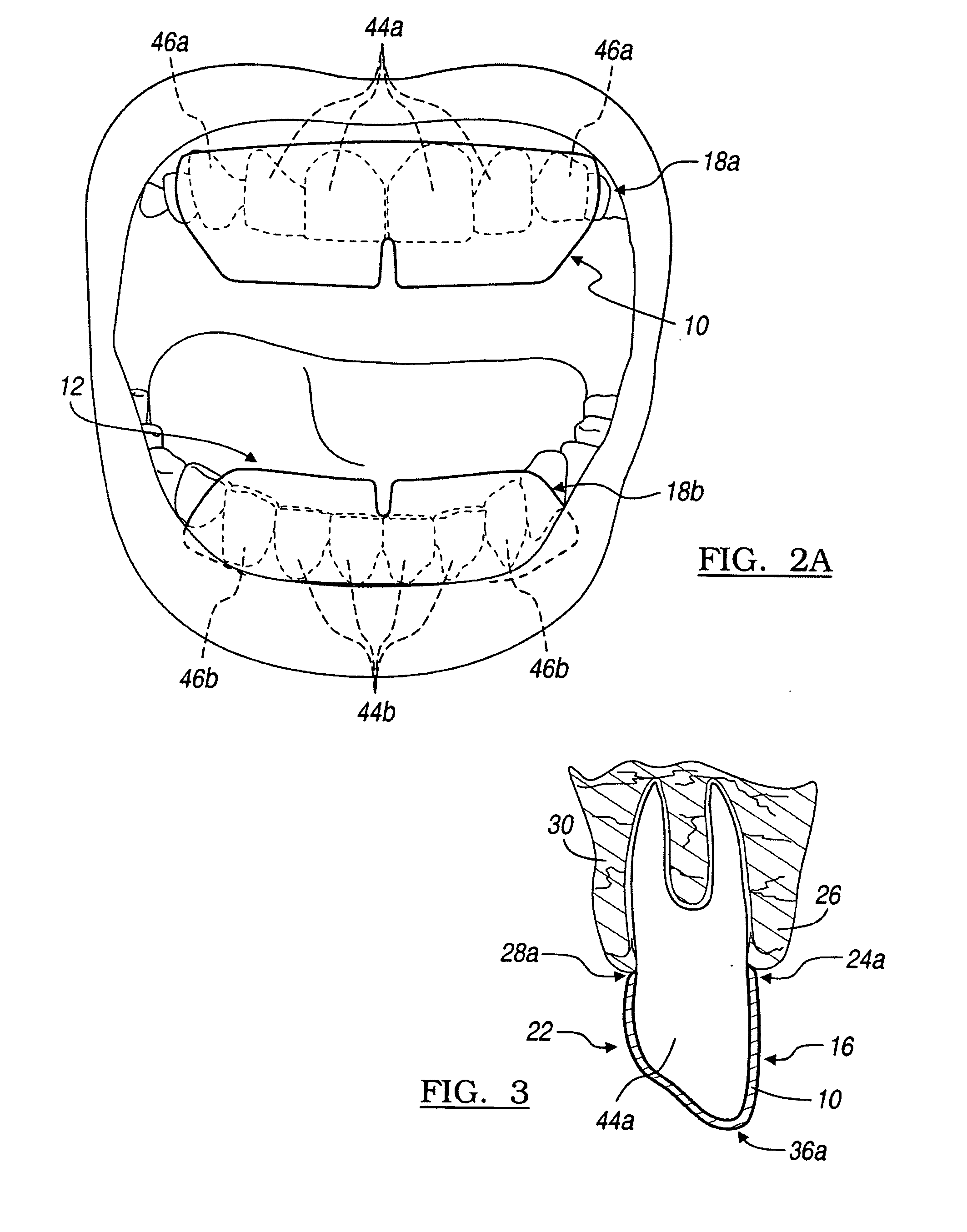 Carrier strip for application to oral surfaces and related methods