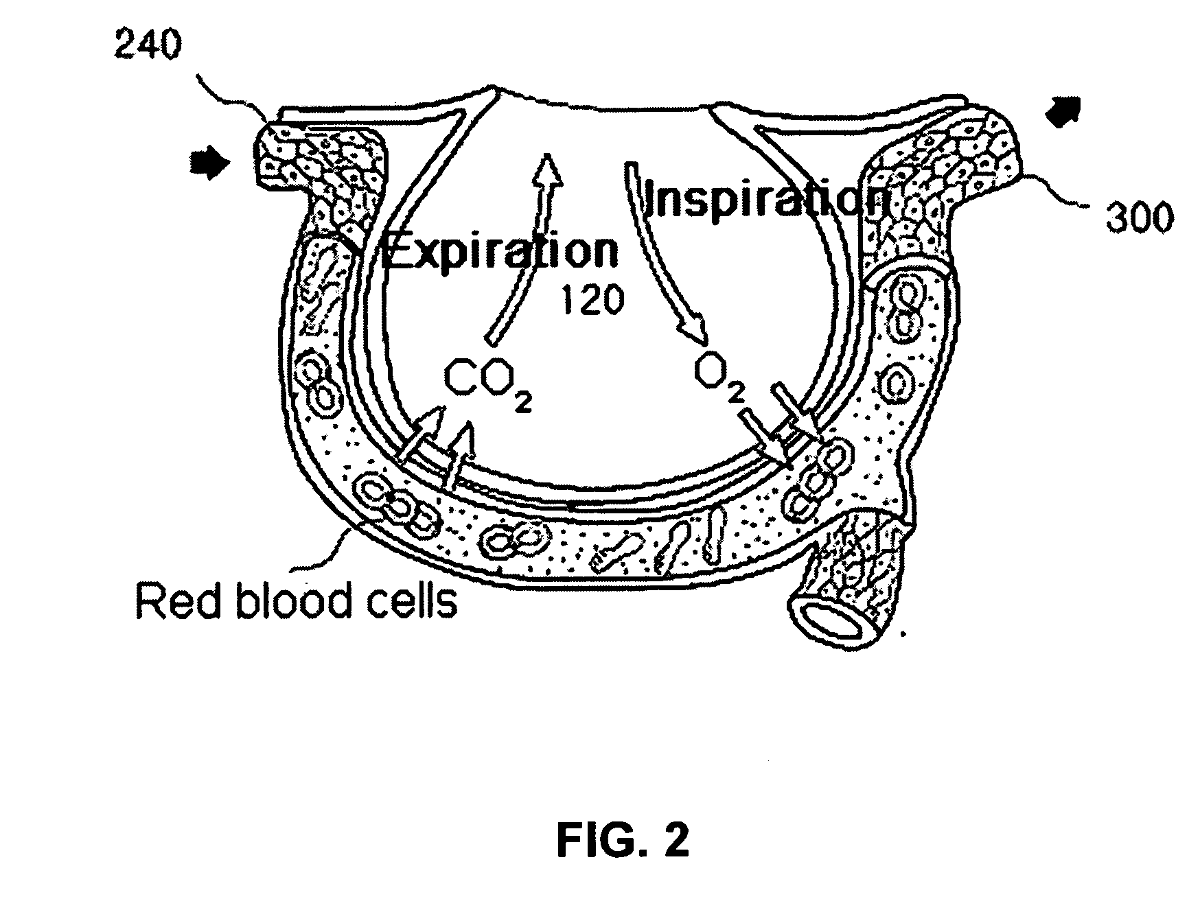 Method and display apparatus for non-invasively determining pulmonary characteristics by measuring breath gas and blood gas