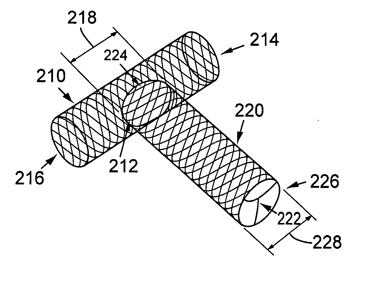 Catheter system with stent apparatus for connecting adjacent blood vessels