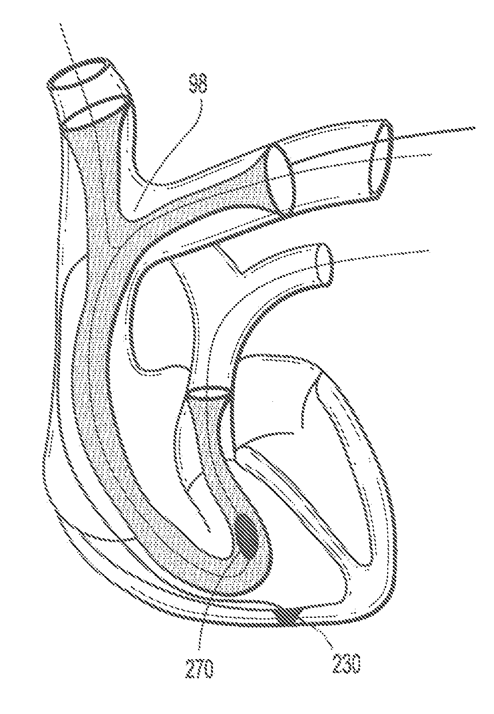 Endovascular conduit device with low profile occlusion members