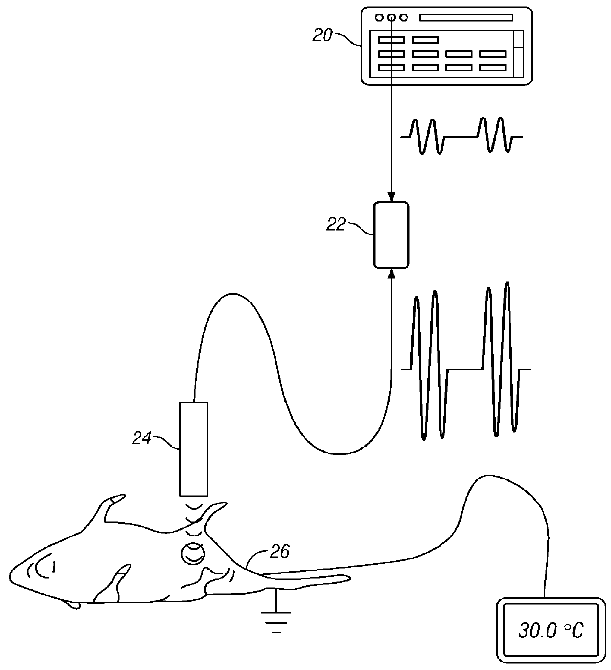 Methods and apparatus for treating a cervix with ultrasound energy
