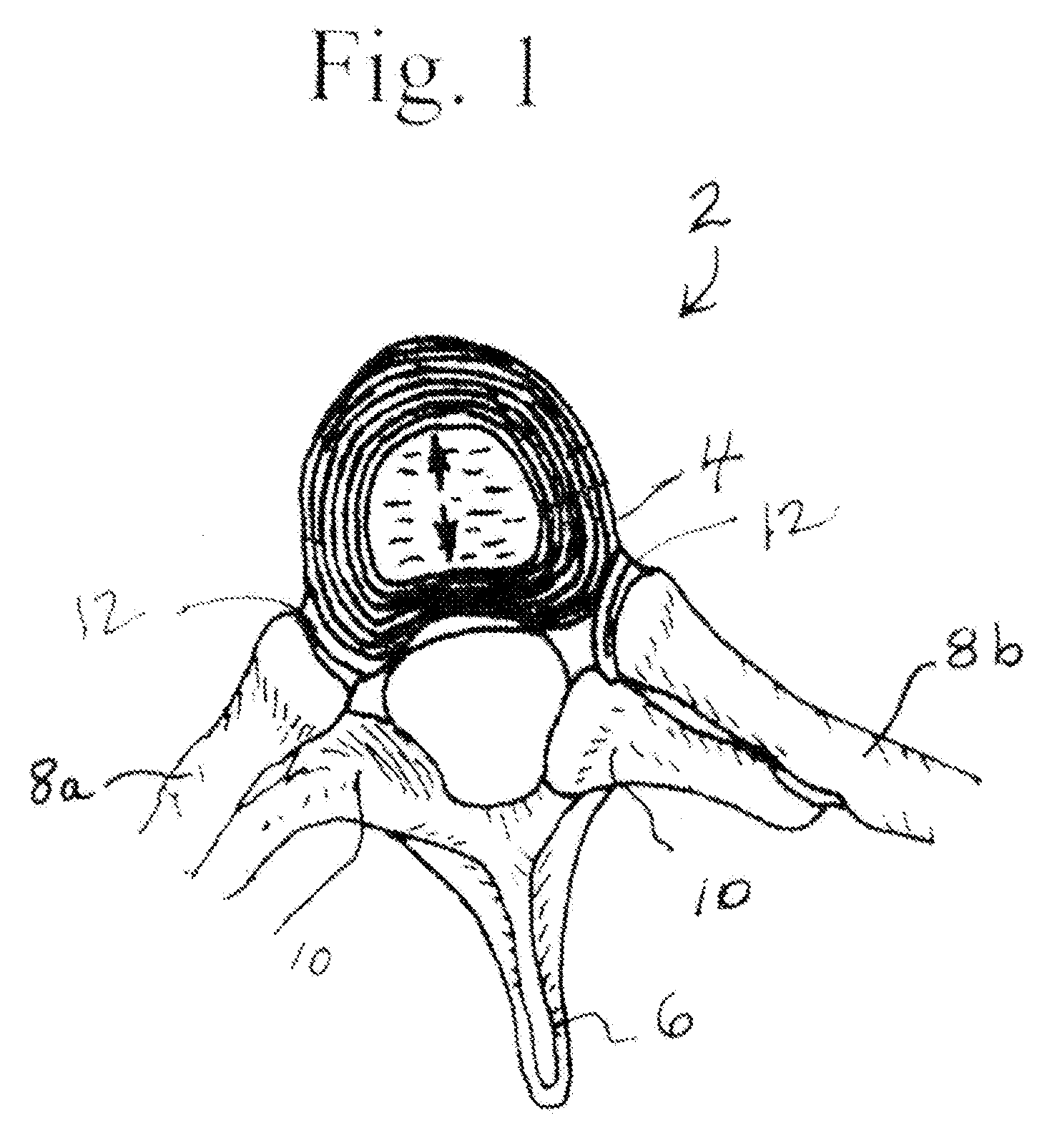 Backrest Apparatus Comprising a Concave Support Pad with Convex End Portions