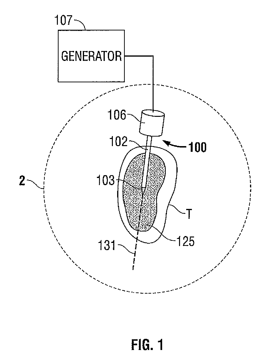 Method for ablation volume determination and geometric reconstruction