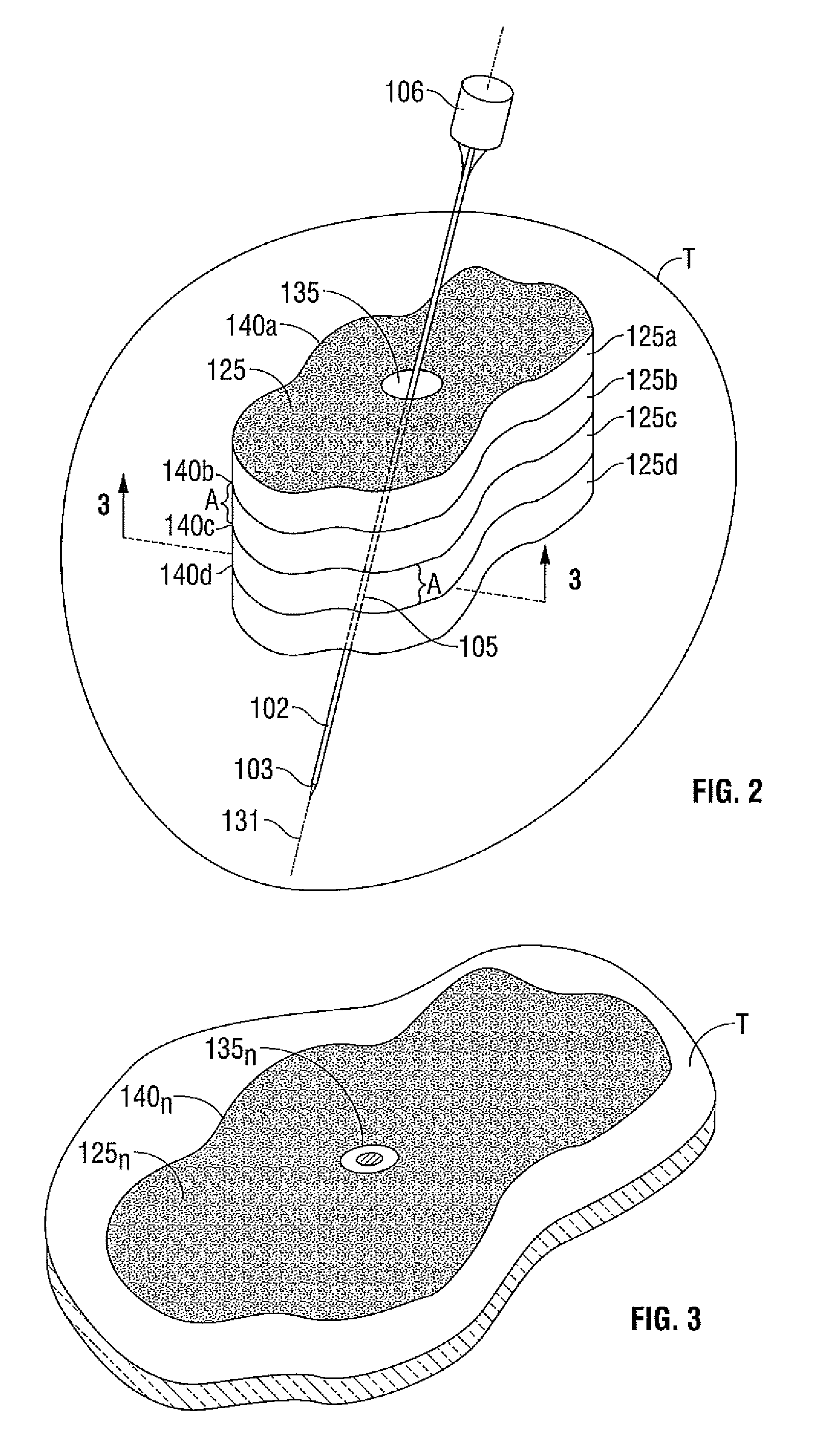 Method for ablation volume determination and geometric reconstruction