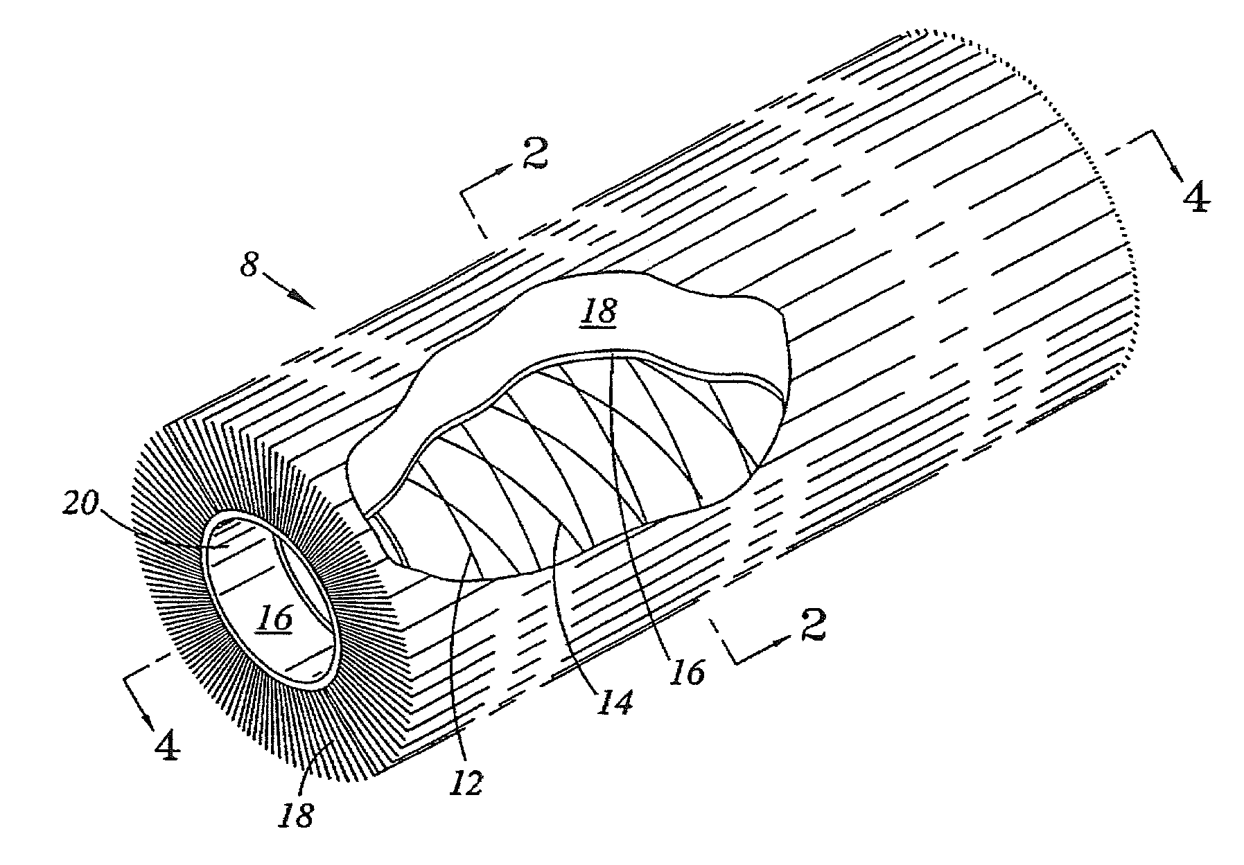 Large vessel stents and occluders