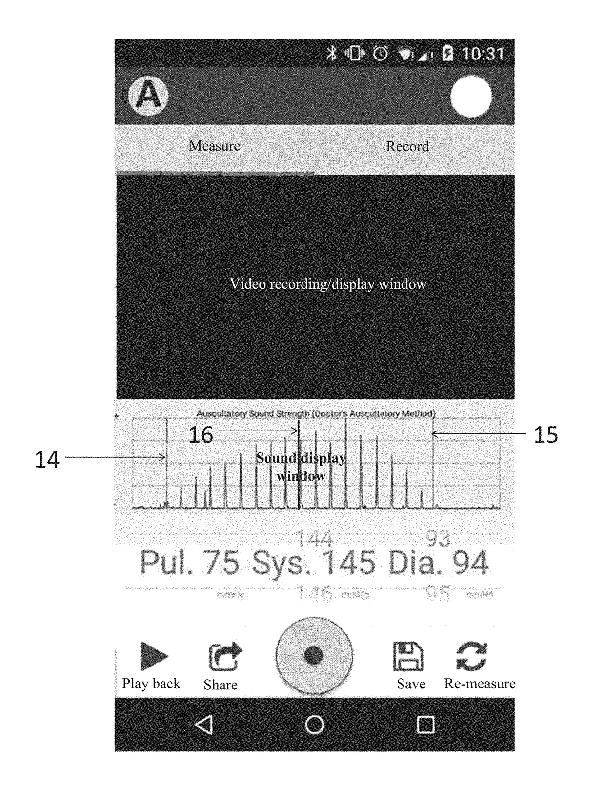 Auxiliary device for blood pressure measurement and blood pressure measuring equipment