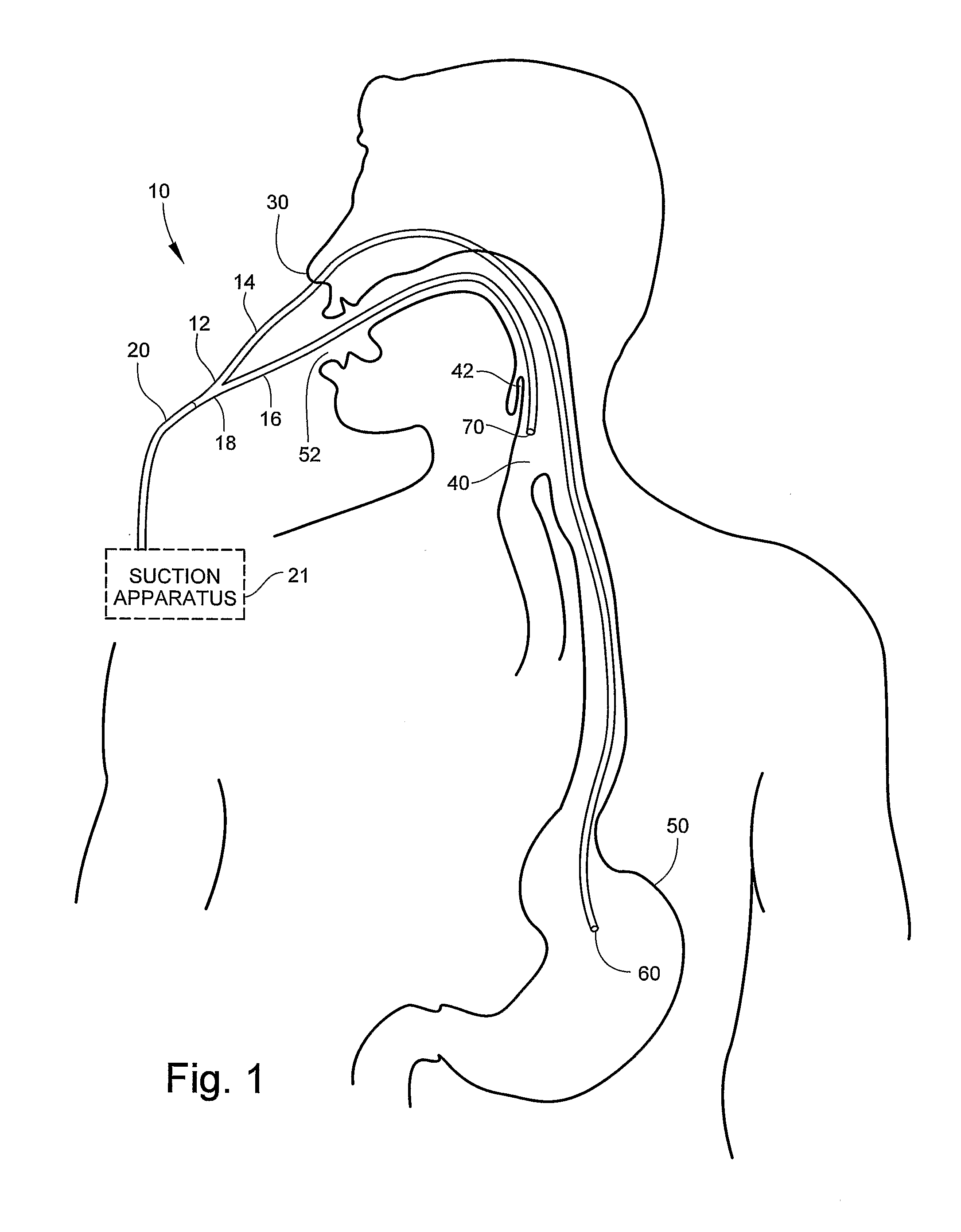 Medical Apparatus with Hypropharyngeal Suctioning Capability