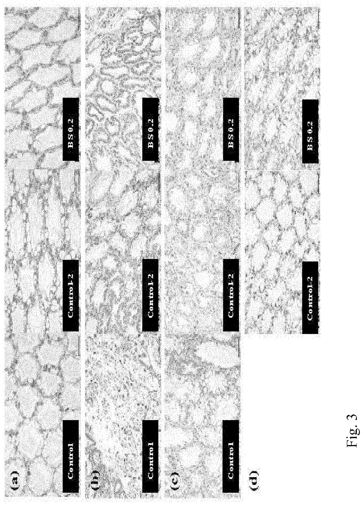 A feed composition for preventing or treating acute hepatopancreatic necrosis disease (AHPND) or white spot syndrome (WSS), comprising  a Bacillus subtilis strain as an active ingredient