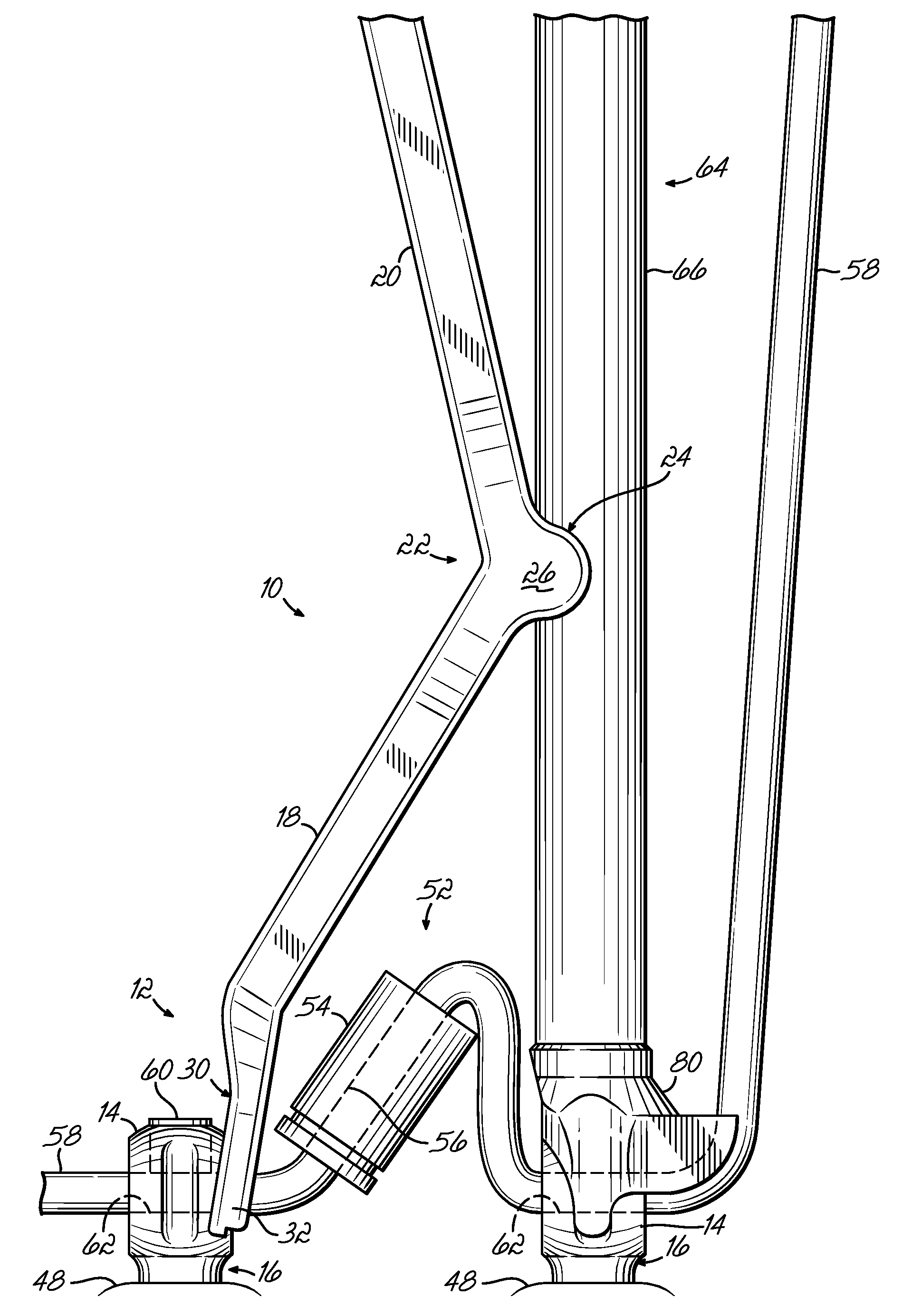 Pedicle screw distractor and associated method of use
