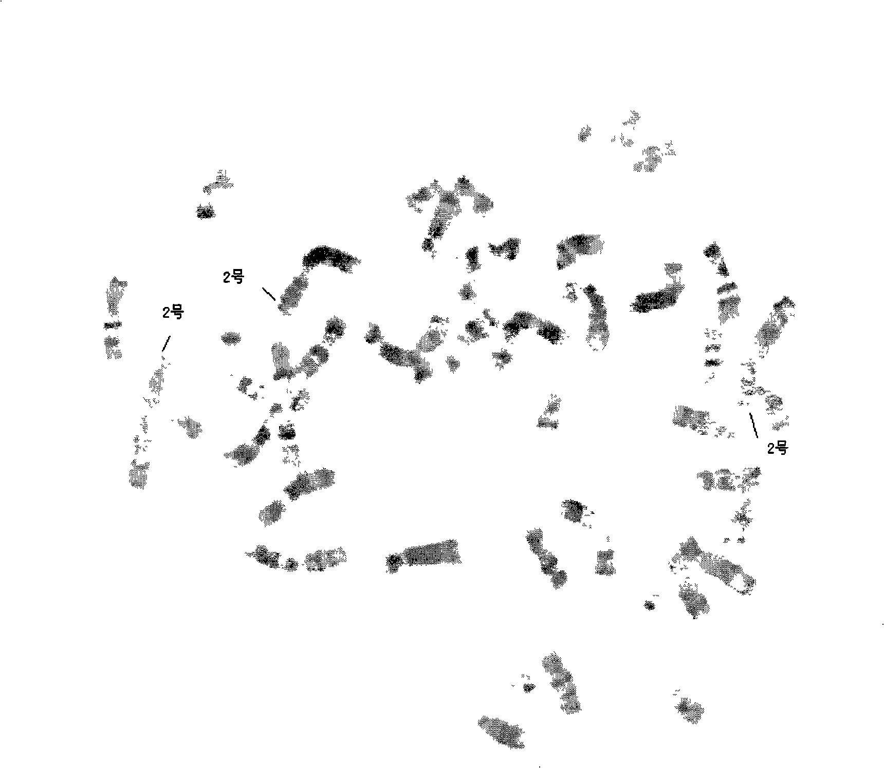 Reagent kit for detecting chromosome numerical abnormalities resulting in natural abortion