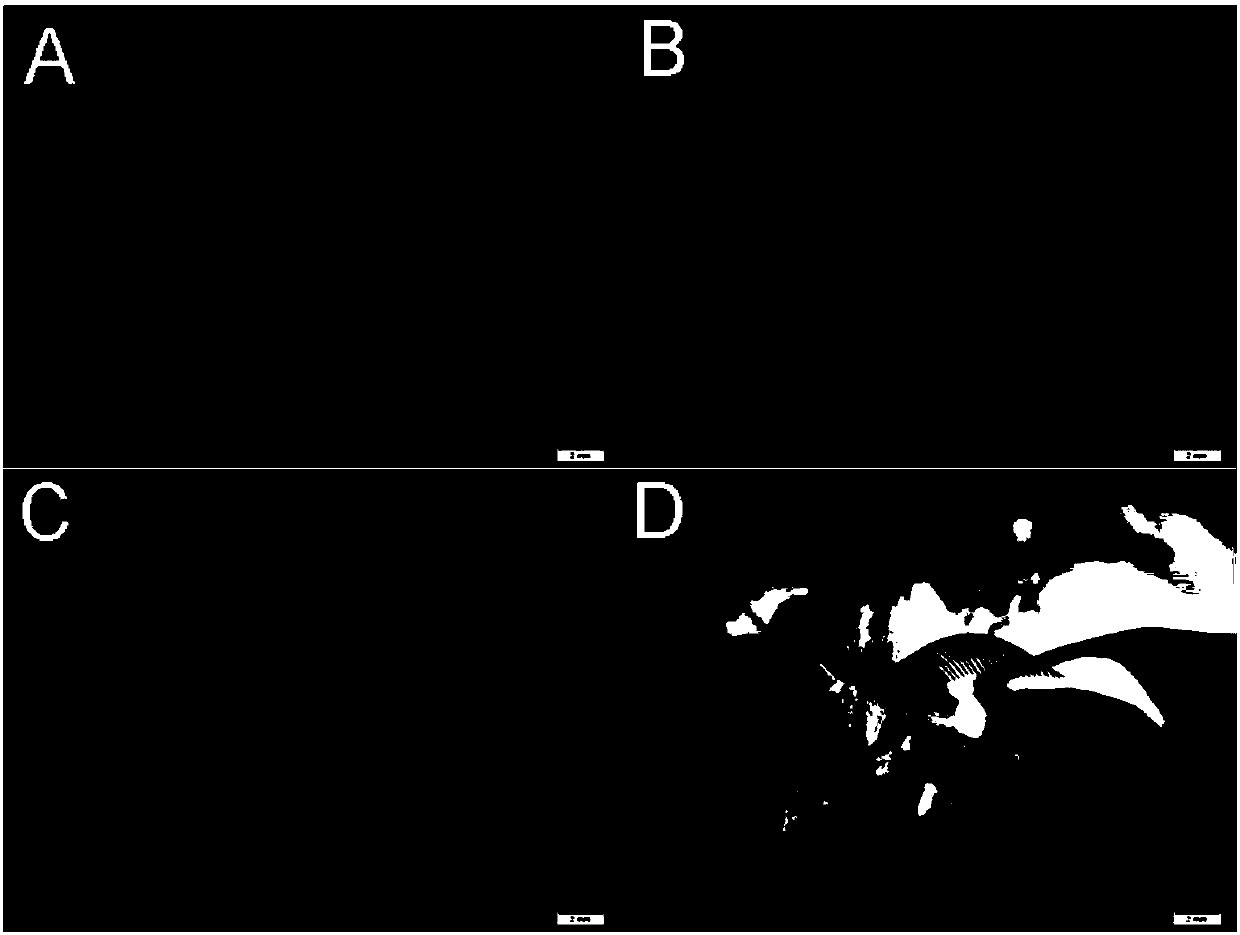 Modified human serum albumin gene suitable for expression in silk gland of silkworm and its expression system and application