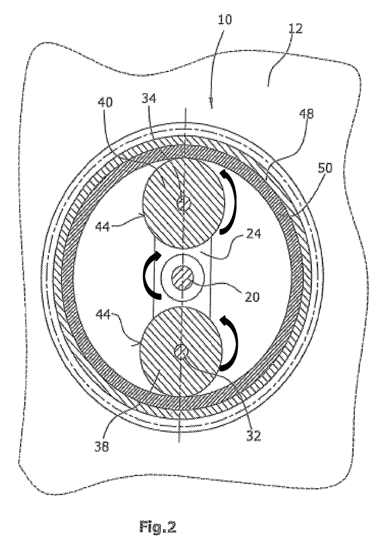 Centrifugal mass arrangement for the balancing of rotational accelerations of an engine housing