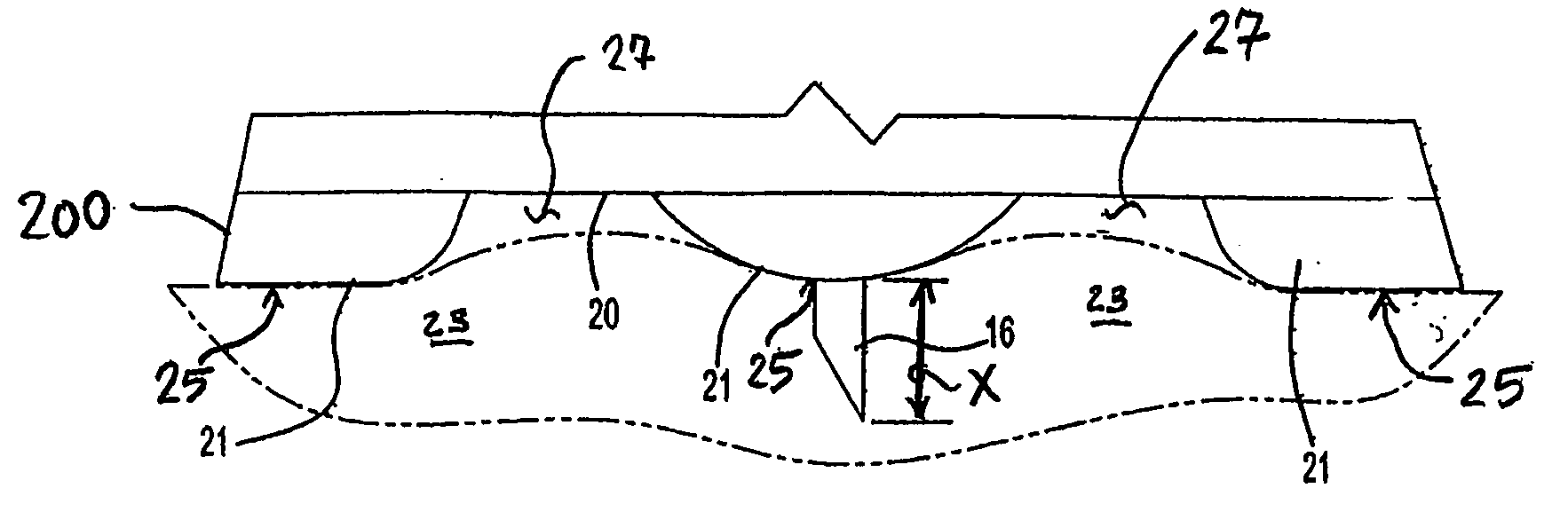 Intradermal delivery device with crenellated skin engaging surface geometry