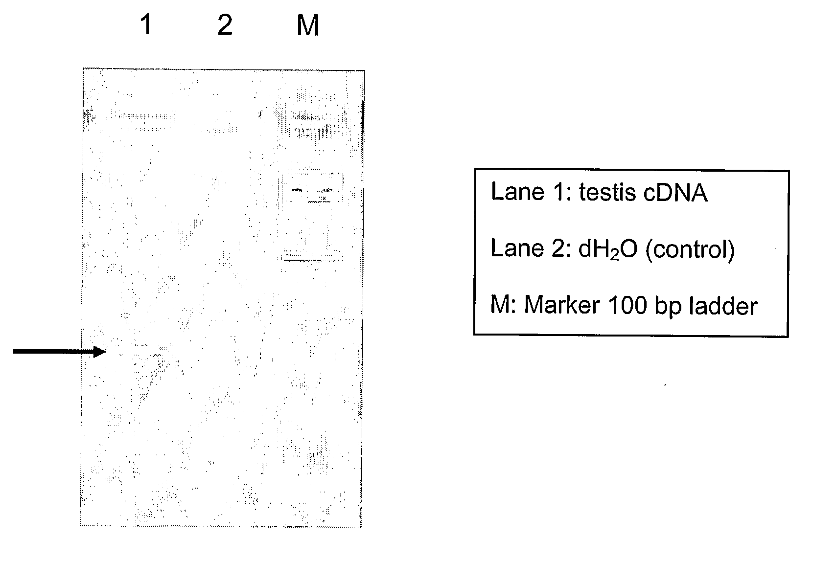 Diagnostic and Therapeutic Use of a Novel Growth Factor, Neublasmin