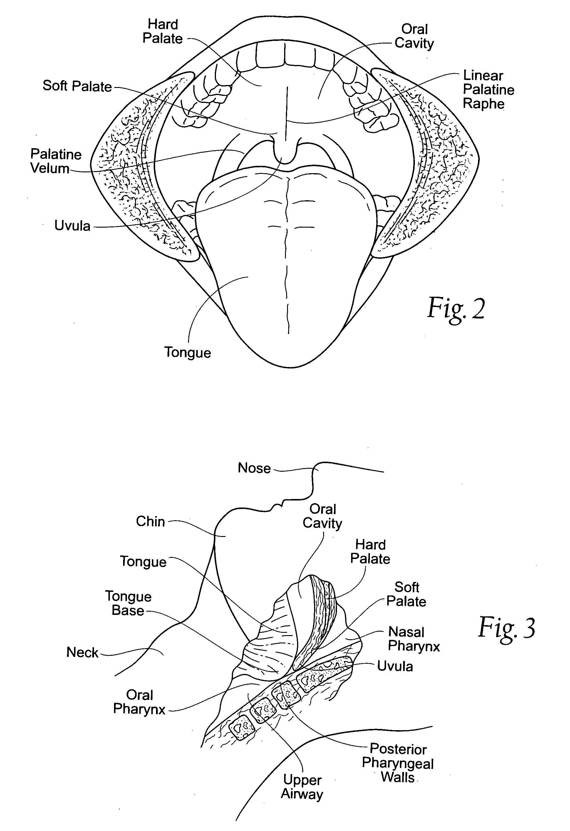 Device, systems and methods having mobile ferromagnetic structures
