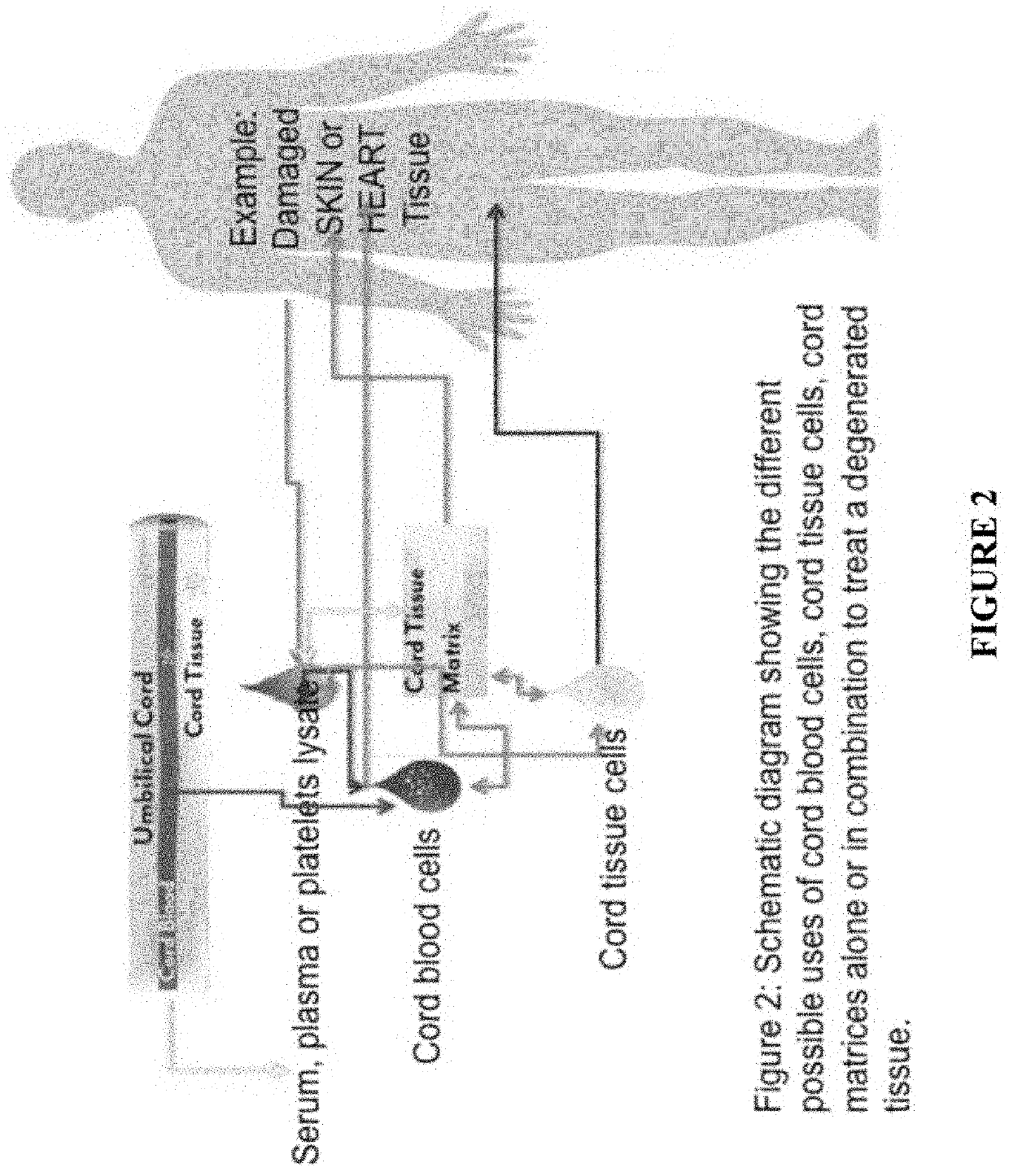 Stem cells & decellularization tissue matrix from cord tissue