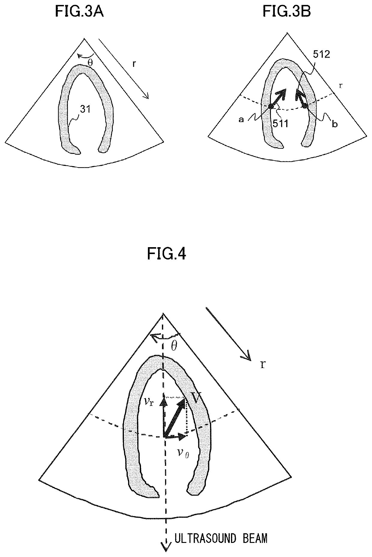 Ultrasound image capture device and ultrasound image capture method