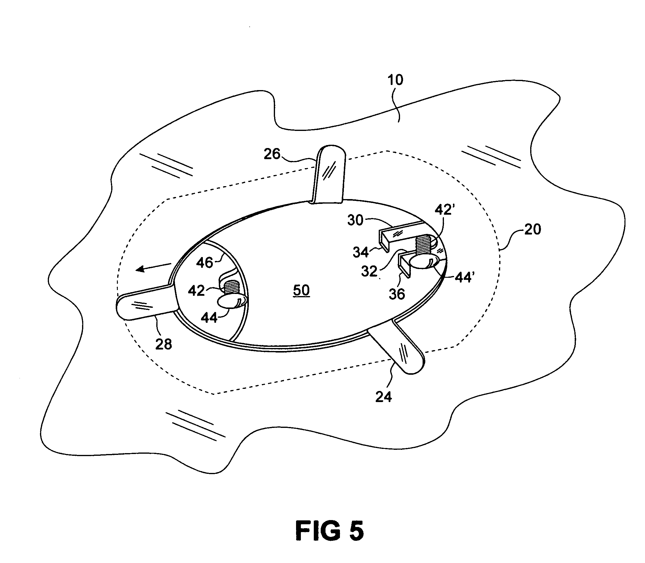 Adapter device for mounting a ceiling electrical light fixture