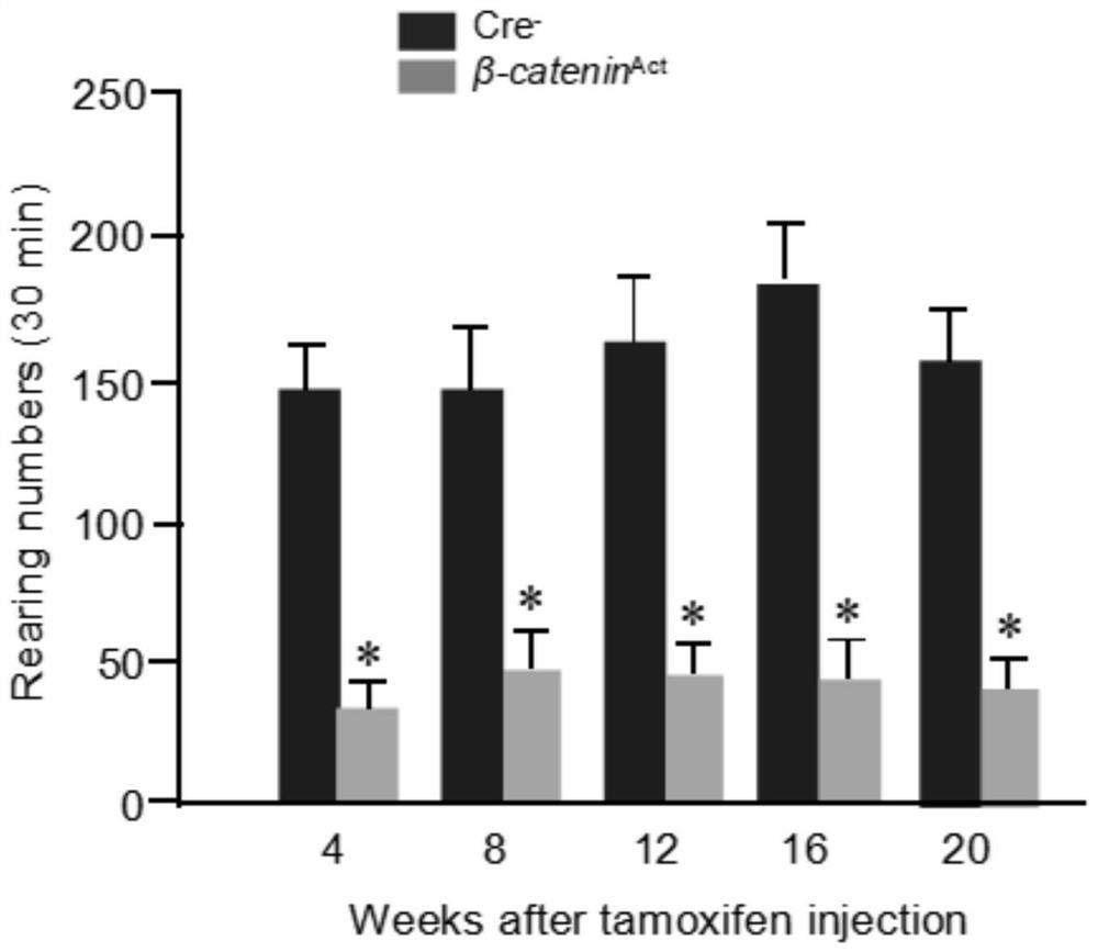 Application of inhibitor and pharmaceutical composition