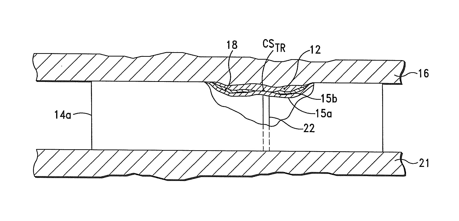 Systems, Apparatus and Methods for Sealing Perivalvular Leaks