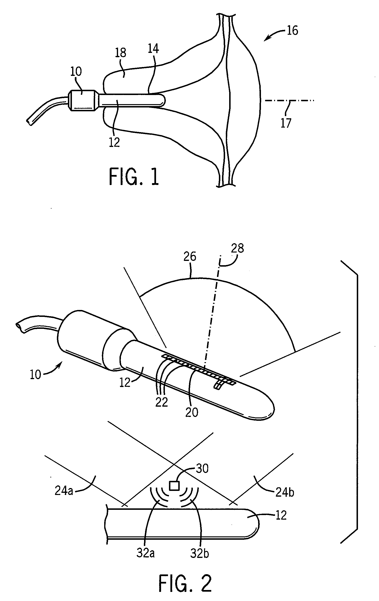 Method and apparatus for assessing risk of preterm delivery