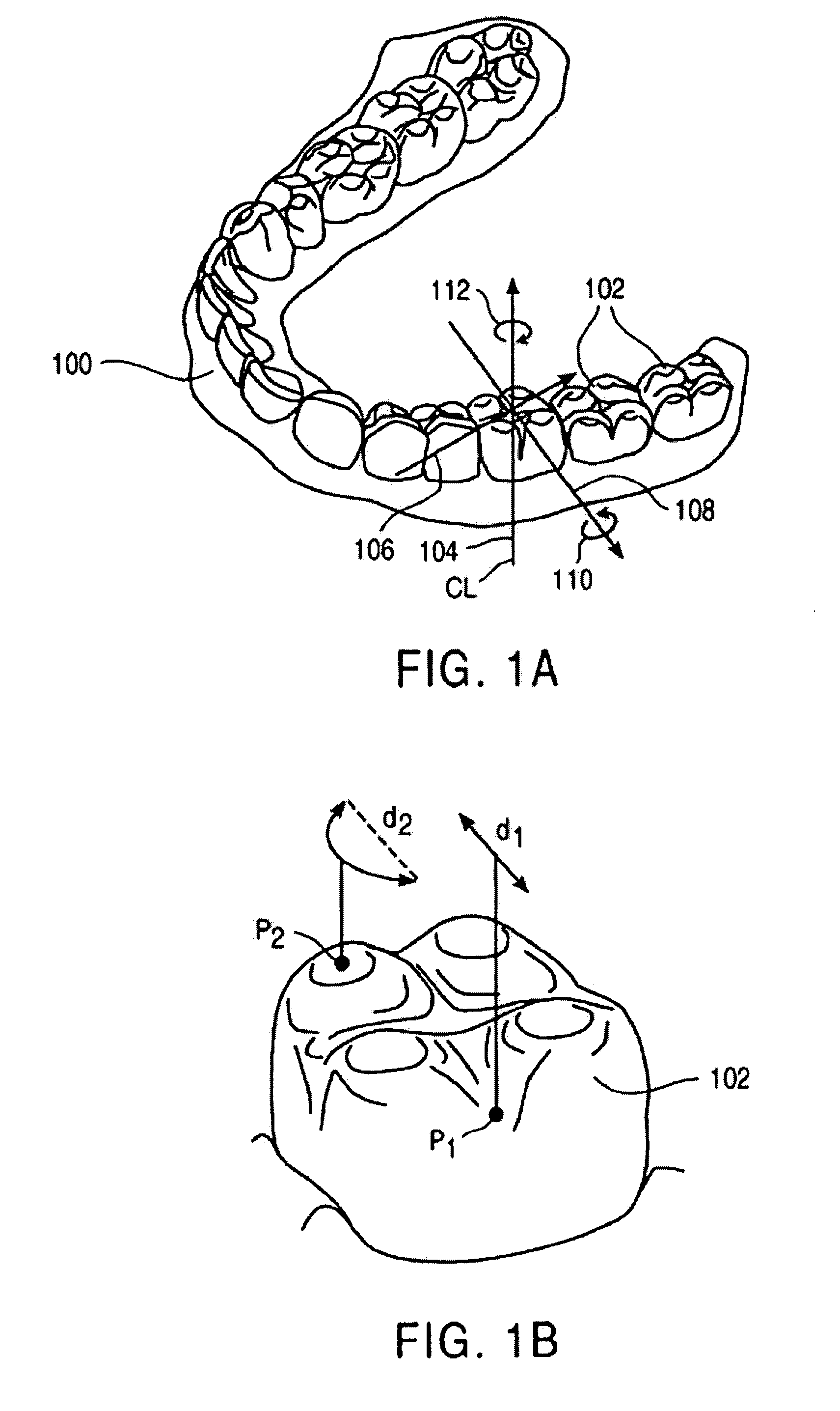 Methods and systems for treating teeth