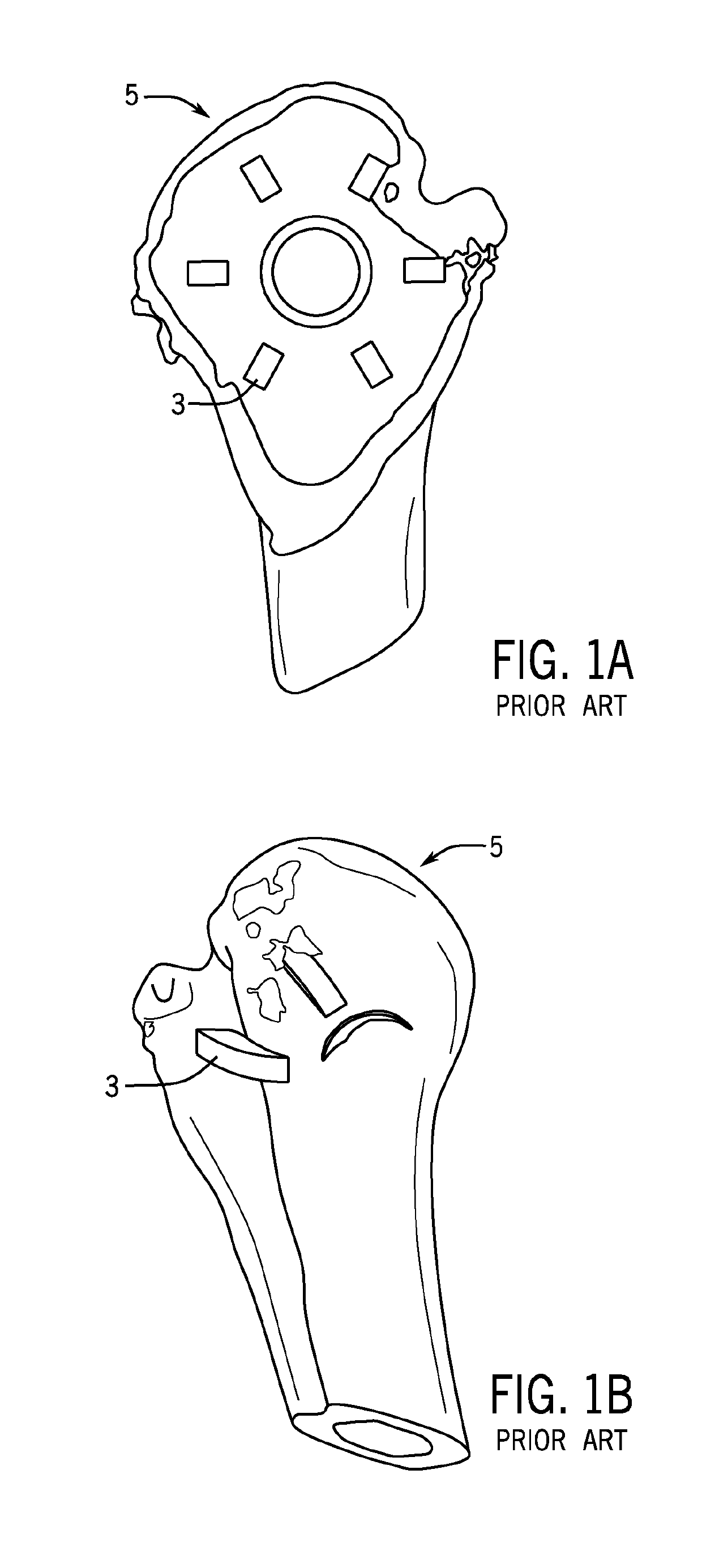 Method for Modeling Humeral Anatomy and Optimization of Component Design