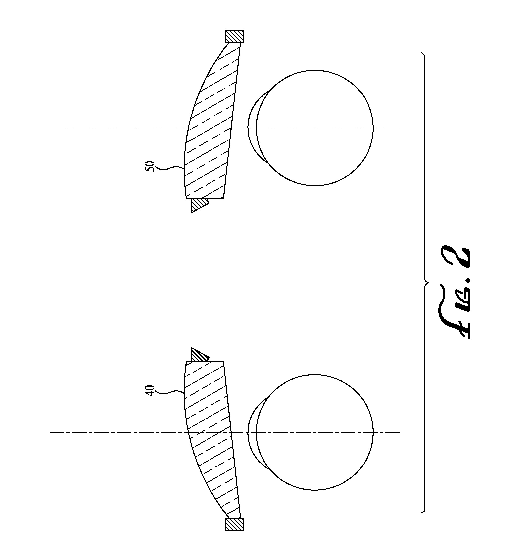 Method and Device for Treating Averted Gaze