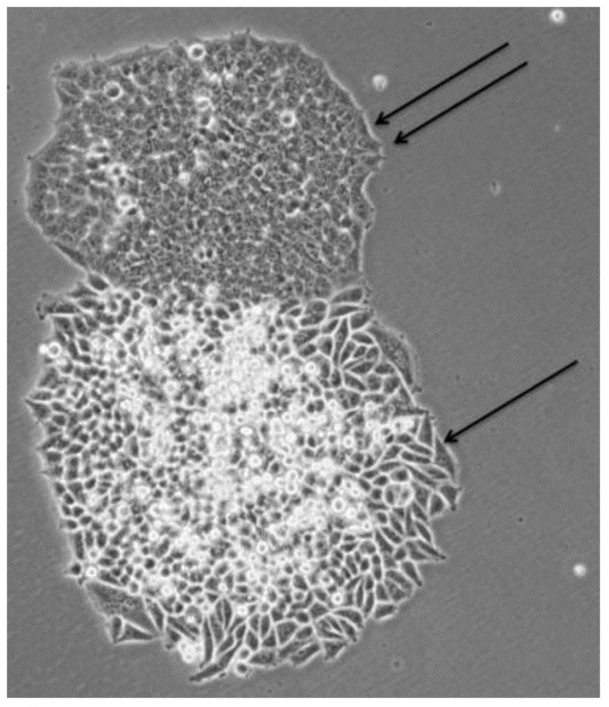 Separating method of tumor stem cells