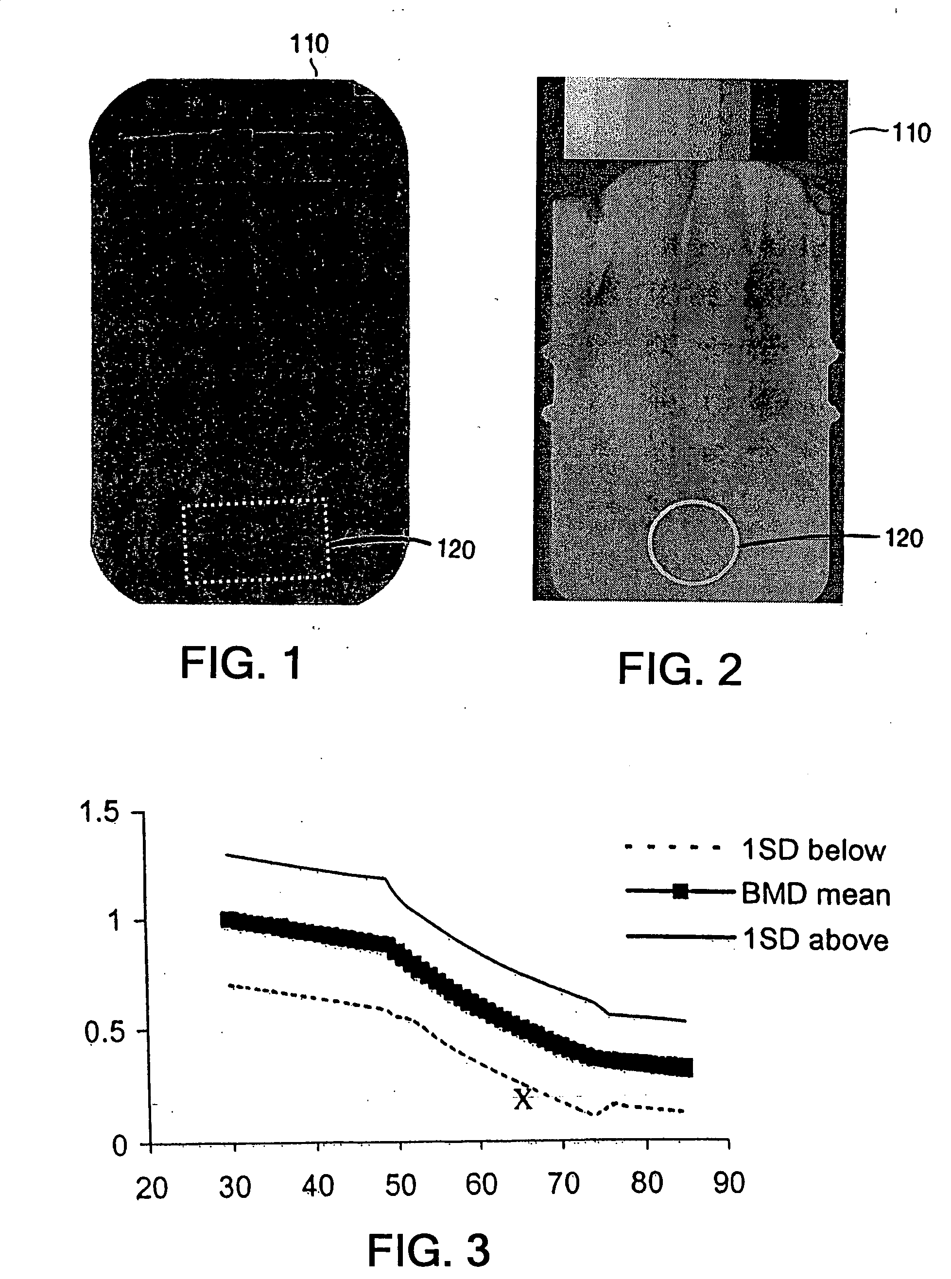 Methods for the compensation of imaging technique in the processing of radiographic images