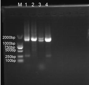 Ribosomal RNA sequence of pathogenic bacterium Septoria sp of oak abnormally withered disease and application thereof