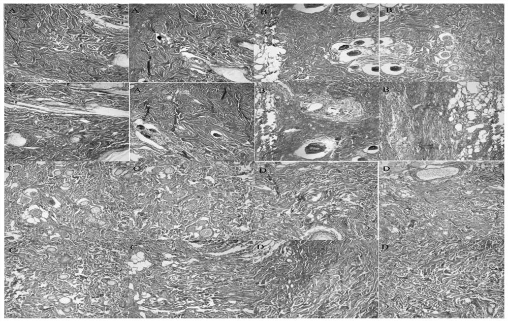 Traditional Chinese medicine plaster for promoting wound healing and reducing scar formation and preparation method thereof