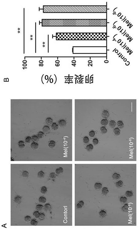 Optimization liquid for in vitro maturation of advanced-age mouse oocytes