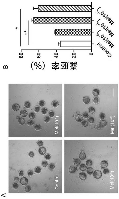 Optimization liquid for in vitro maturation of advanced-age mouse oocytes